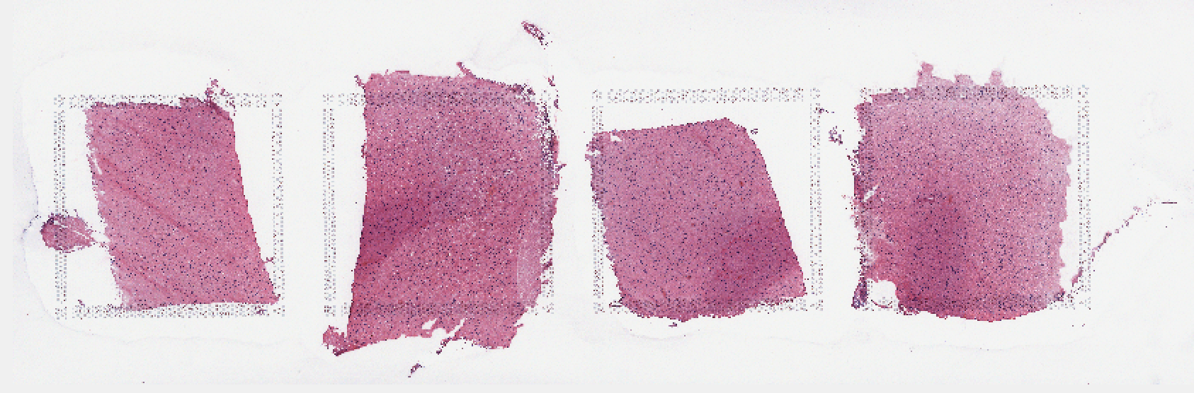 An example bright field image with four Visium tissue capture areas. Source: [`VistoSeg`](http://research.libd.org/VistoSeg/step-1-split-visium-histology-whole-slide-image-into-individual-capture-area-images.html).