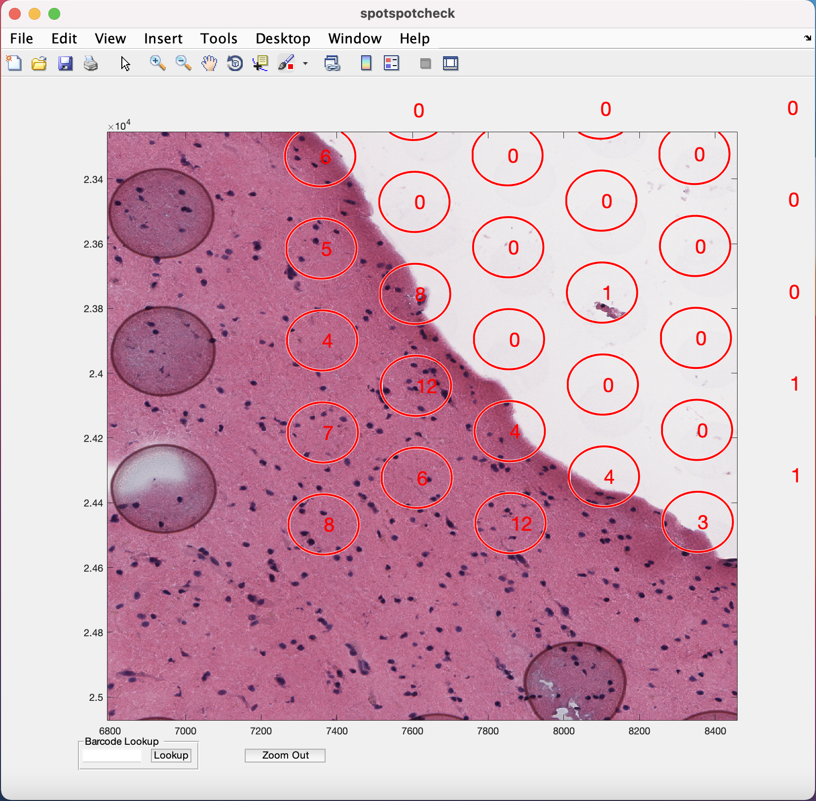 A screenshot of the `spotspotcheck` GUI from `VistoSeg` that can be used for counting the number of cells or nuclei per Visium spot. Source: [`VistoSeg`](http://research.libd.org/VistoSeg/step-4-gui-to-count-nuclei-in-a-visium-spot.html).