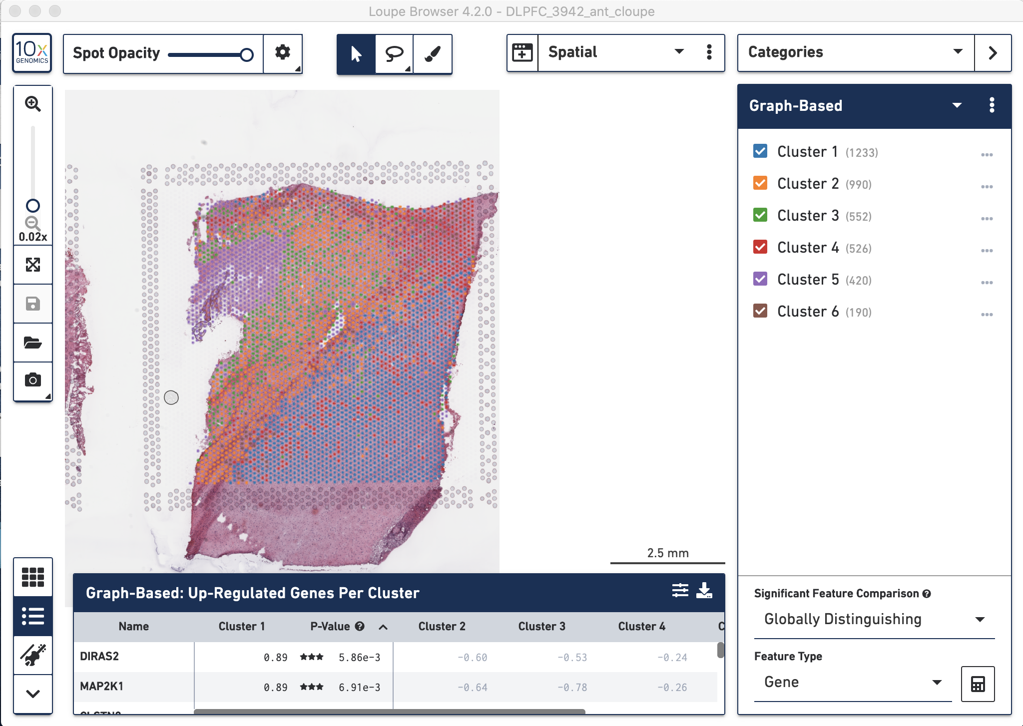 Visual inspection of the graph-based clustering results from `spaceranger count` visualized with the tissue histology image in the background using `Loupe`.